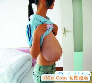 16����Ů��������֢�� ˫��16�ﵽ����λ��