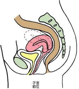 子宫前位,后位图解,以及自我治疗方法